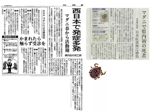 新聞記事
マダニで県内初の死者
西日本で発症多発
マダニ春から活動期
かまれたら触らず受診を